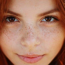 Tips on how to get rid of freckles from the skin by the help of lemon