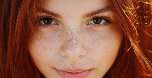 Tips on how to get rid of freckles from the skin by the help of lemon