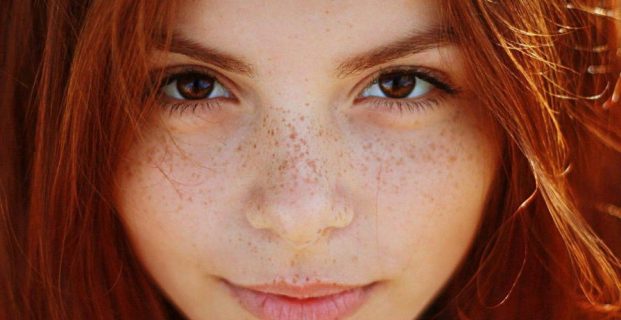 Tips on how to get rid of freckles from the skin by the help of lemon